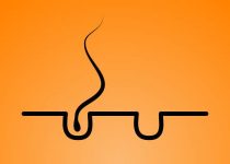 17. A Single Hair and the Trouble it Caused